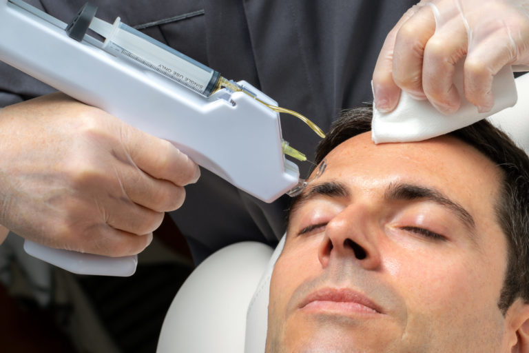 How Long Does It Take to See Results from Alma Opus