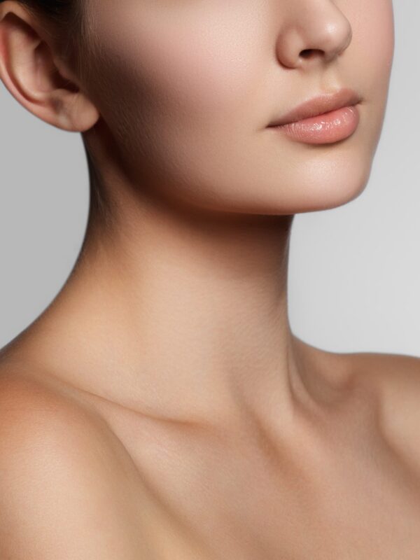 Kybella Kybella